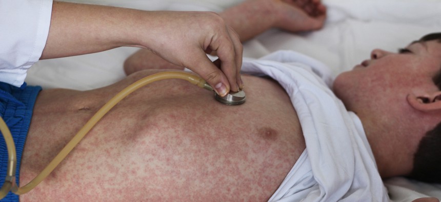 Measles outbreaks have appeared across the country.