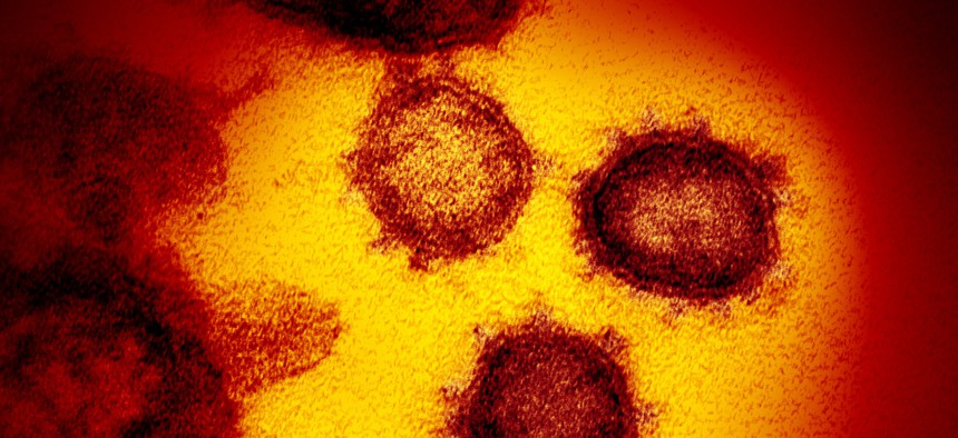 This electron microscope image made available by the U.S. National Institutes of Health in February 2020 shows the Novel Coronavirus SARS-CoV-2.